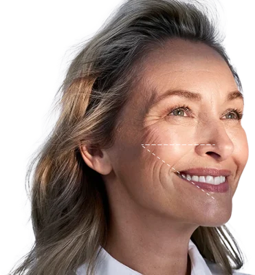 image_compressed_transparent image_compressed_transparent